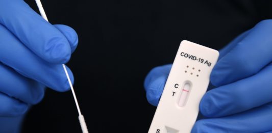 I test anti-COVID restino gratuiti e si diversifichino i vaccini!